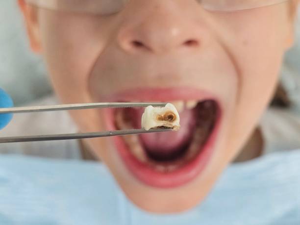 Best Weekend Emergency Dentist in Greensboro, GA
